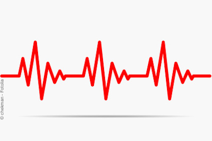 EKG, Herzrhythmus-Kurve: Herzrhythmusstörungen wie Vorhofflimmern sind Risikofaktoren für einen Schlaganfall.