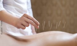 Kreuzschmerzen durch Akupunktur lindern