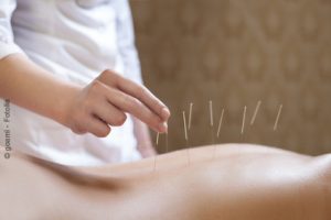 Akupunktur ist auch bei Arthritis wirksam. 