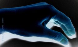 Schmerzende Finger: das Raynaud-Phänomen